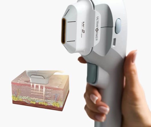 Classys Ultraformer III